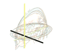 EEG image from initial analysis showing normal activity